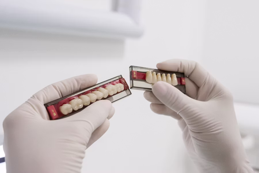 Cura dell'impianto dentale — Centro Medico Piazza Fanti