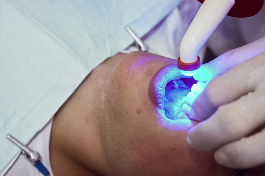 Sbiancamento denti professionale in studio — Centro Medico Piazza Fanti
