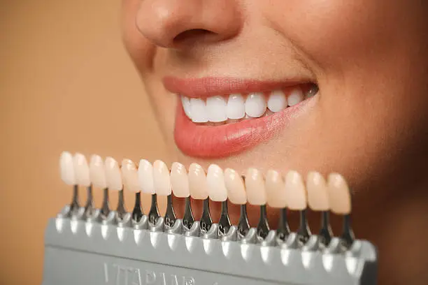 Sorriso perfetto con trattamenti di estetica dentale — Centro Medico Piazza Fanti